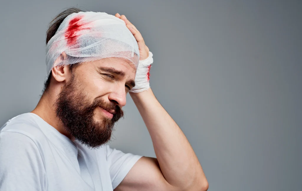 Car Accident Traumatic Brain Injuries and How to Protect Your Rights